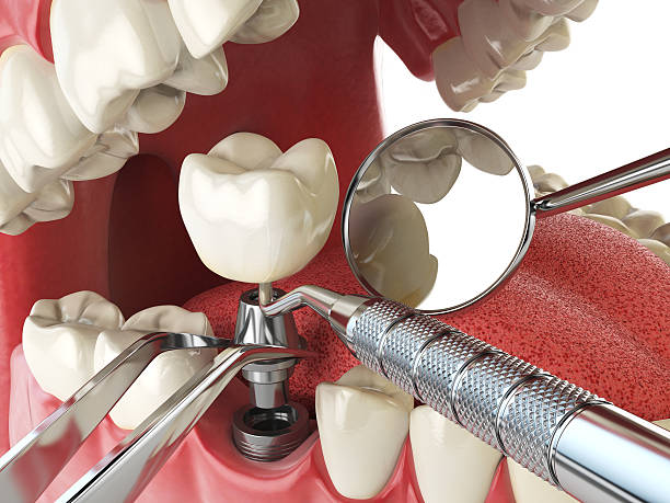 Best Weekend Emergency Dentist in Jackson, SC